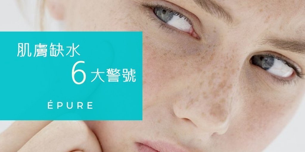 肌膚缺水6大警號 - éPure