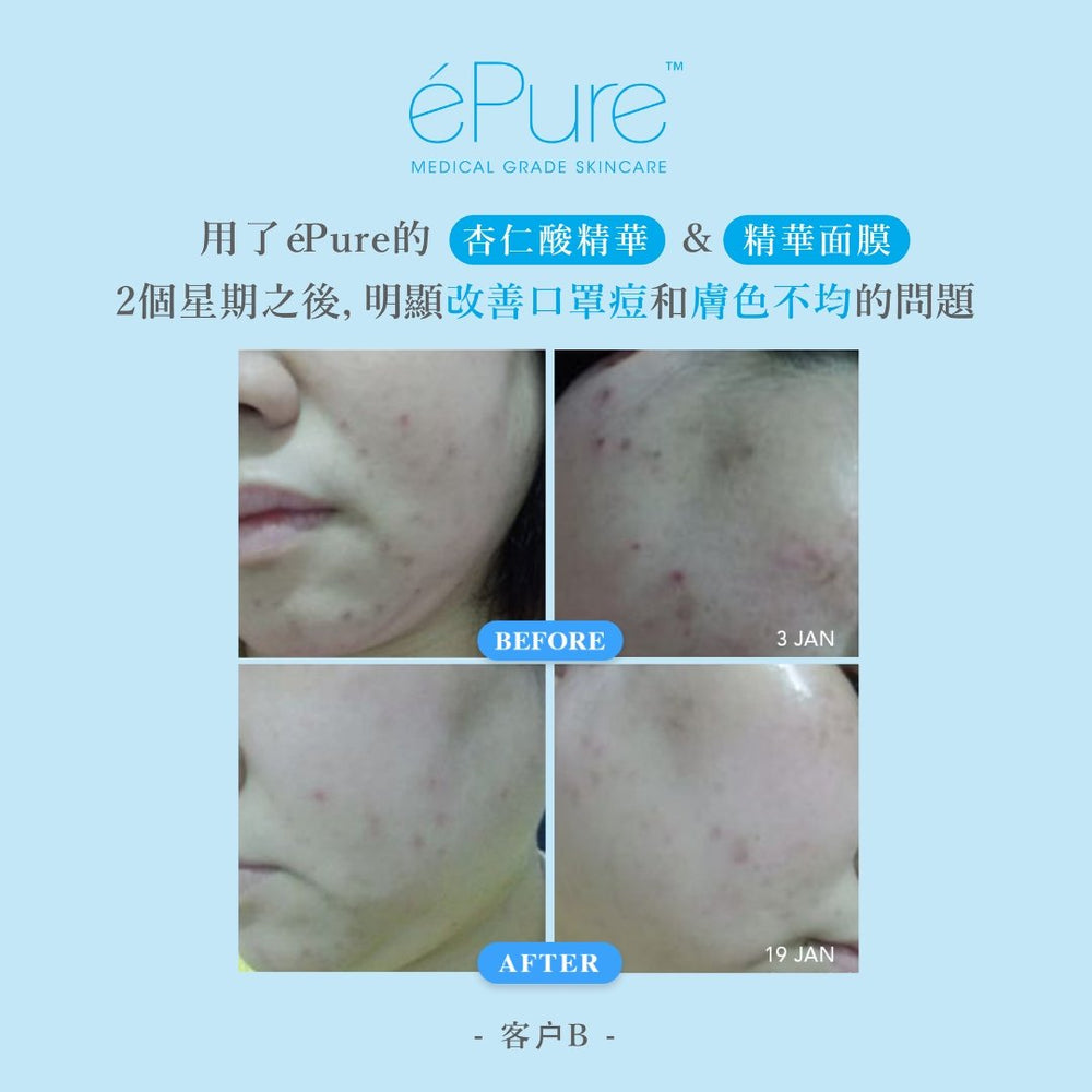 
                  
                    20% 杏仁酸煥膚亮白精華 - éPure
                  
                