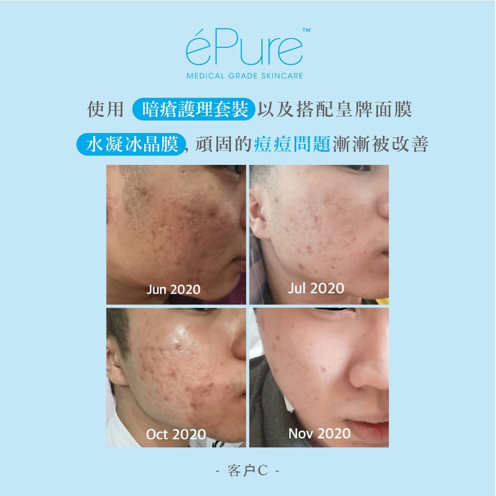 
                  
                    20% 杏仁酸煥膚亮白精華 - éPure
                  
                